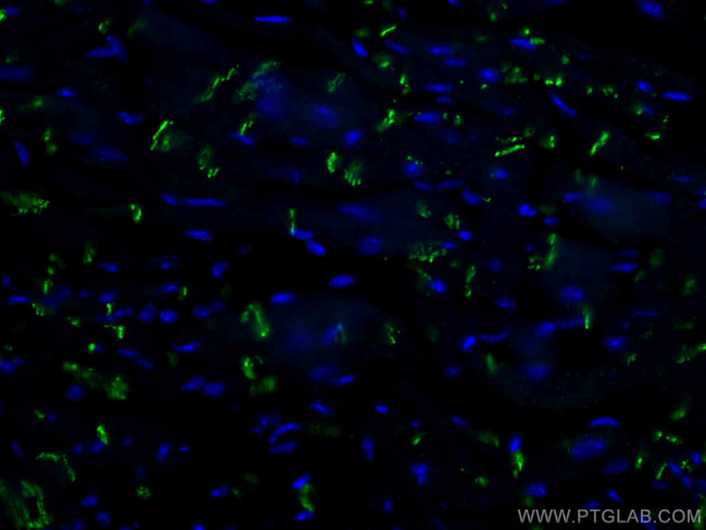 N-cadherin Antibody in Immunohistochemistry (Paraffin) (IHC (P))