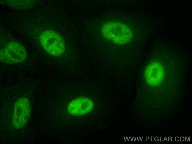 Glucocorticoid receptor Antibody in Immunocytochemistry (ICC/IF)