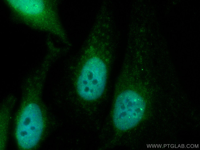 RELB Antibody in Immunocytochemistry (ICC/IF)