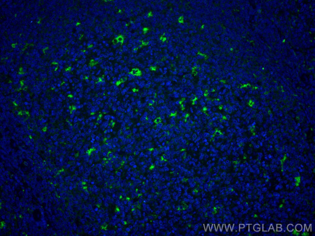 CD68 Antibody in Immunohistochemistry (Paraffin) (IHC (P))
