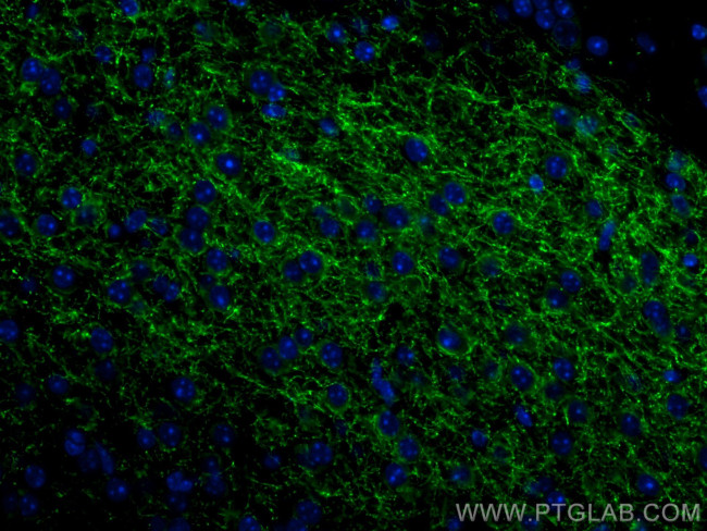 TH Antibody in Immunohistochemistry (Paraffin) (IHC (P))