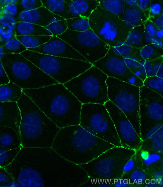 Occludin Antibody in Immunocytochemistry (ICC/IF)
