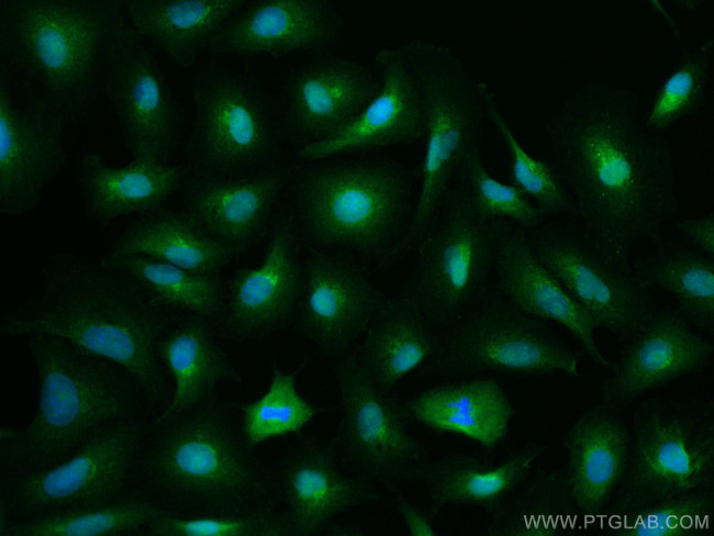 BCL10 Antibody in Immunocytochemistry (ICC/IF)