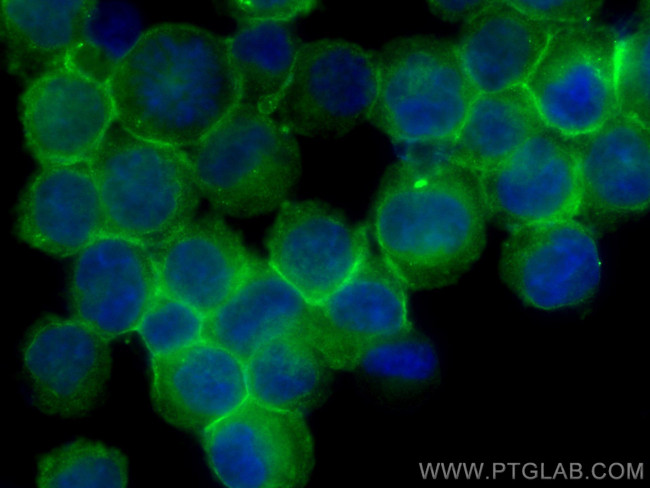 IFITM1 Antibody in Immunocytochemistry (ICC/IF)