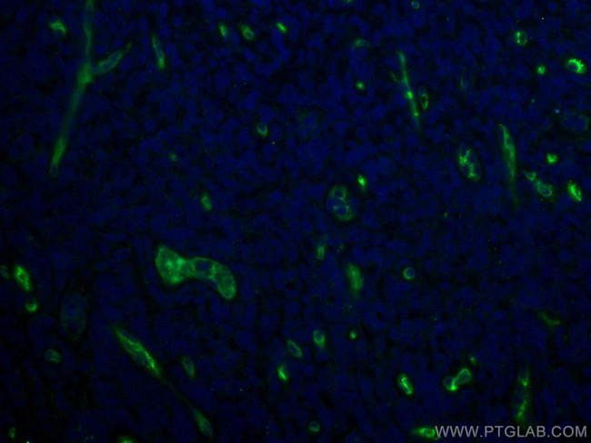 CD34 Antibody in Immunohistochemistry (Paraffin) (IHC (P))