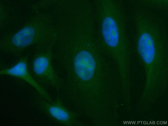 LYN Antibody in Immunocytochemistry (ICC/IF)