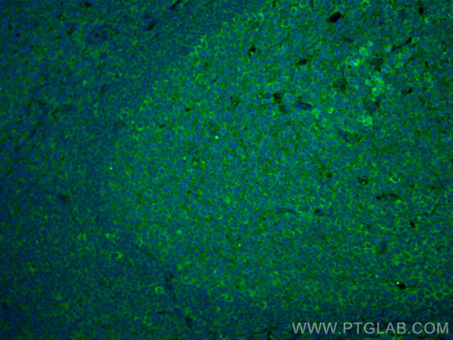 IL-28A Antibody in Immunohistochemistry (Paraffin) (IHC (P))