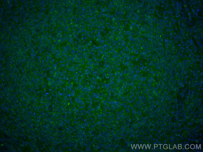 CD45 Antibody in Immunohistochemistry (Paraffin) (IHC (P))