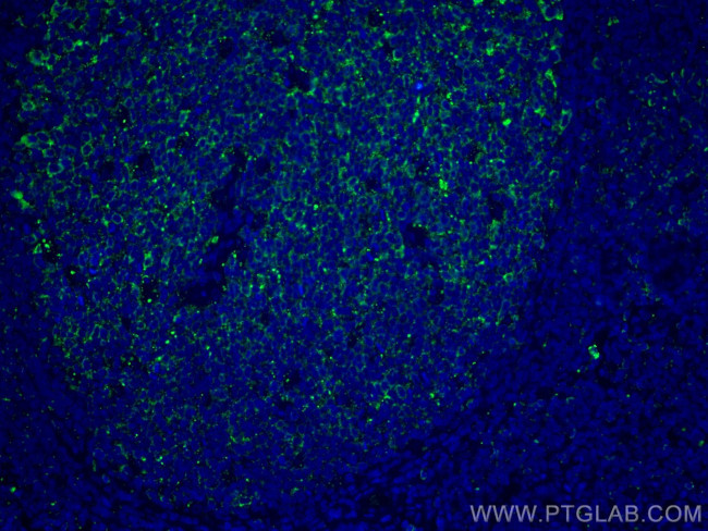 IL-36 Beta/IL-1F8 Antibody in Immunohistochemistry (Paraffin) (IHC (P))