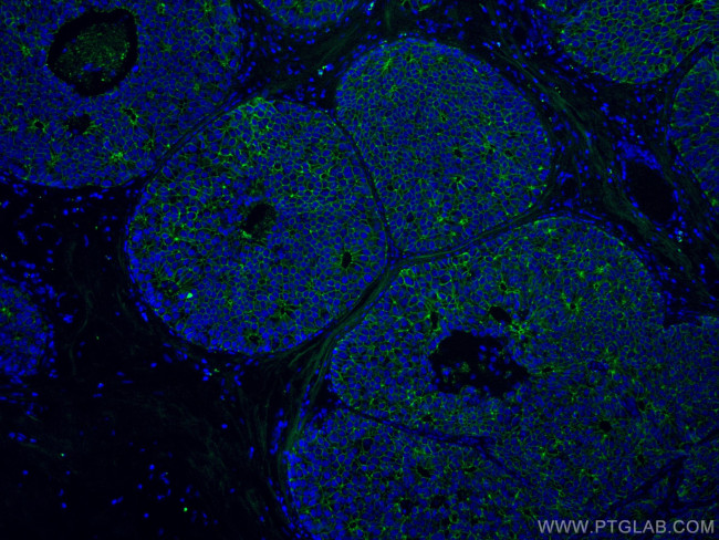 E-cadherin Antibody in Immunohistochemistry (Paraffin) (IHC (P))