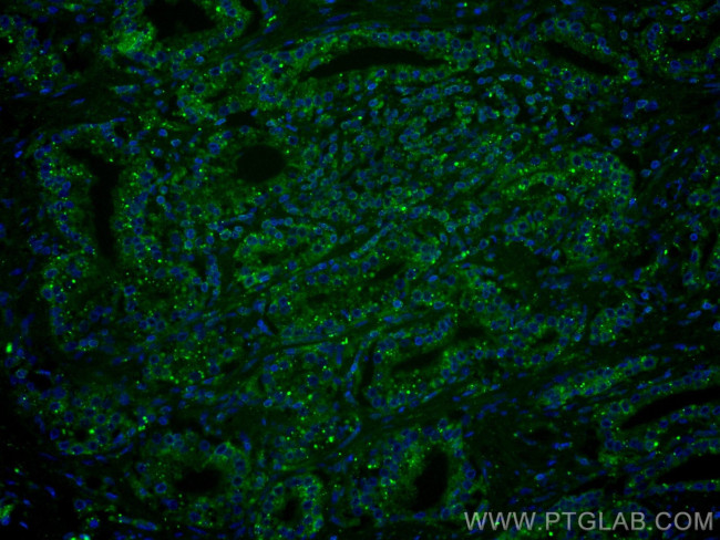 Prostein Antibody in Immunohistochemistry (Paraffin) (IHC (P))