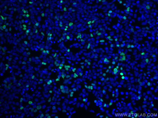 DYKDDDDK Antibody in Immunocytochemistry (ICC/IF)