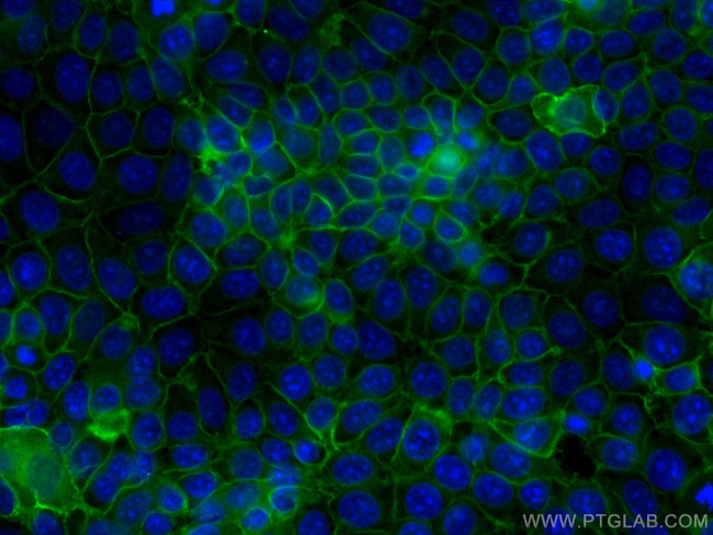 GNAS Antibody in Immunocytochemistry (ICC/IF)