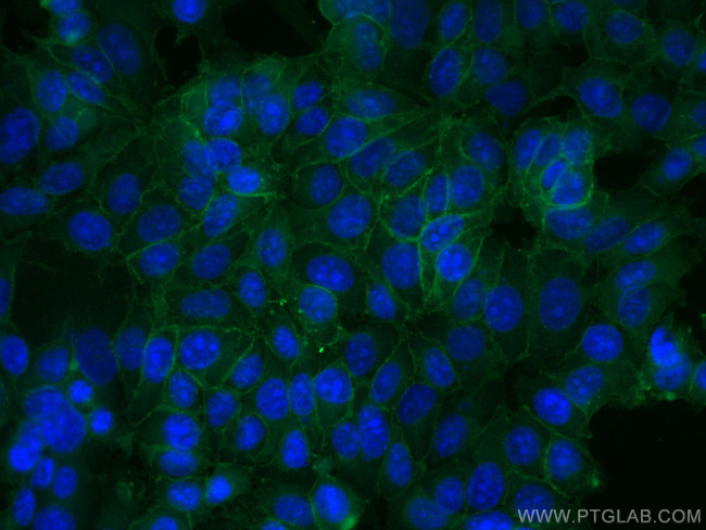 EPCAM/CD326 Antibody in Immunocytochemistry (ICC/IF)