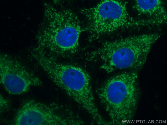 SFRP2 Antibody in Immunocytochemistry (ICC/IF)