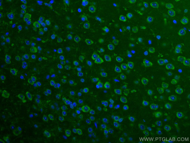BRE Antibody in Immunohistochemistry (Paraffin) (IHC (P))
