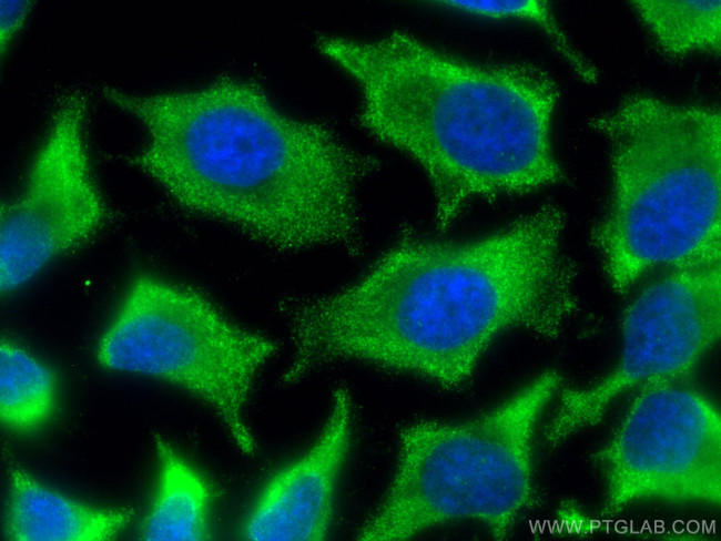 POMC Antibody in Immunocytochemistry (ICC/IF)