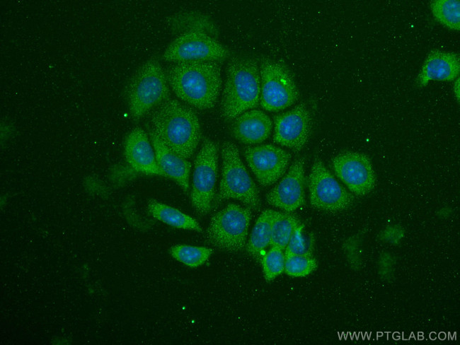 MMP2 Antibody in Immunocytochemistry (ICC/IF)