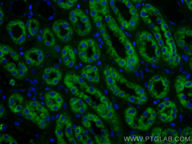 PCCB Antibody in Immunohistochemistry (Paraffin) (IHC (P))