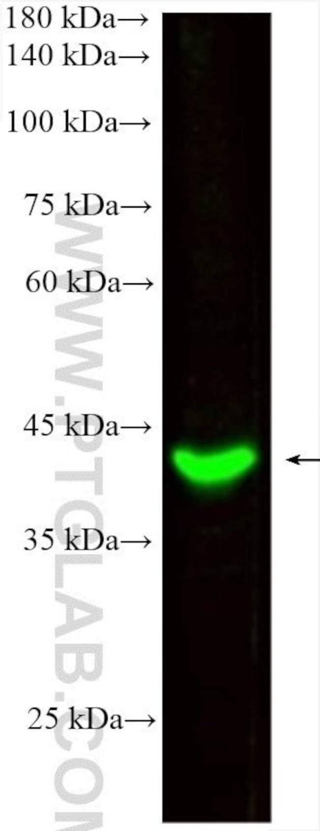 HLA-E Antibody in Western Blot (WB)