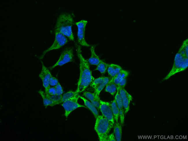 AP5Z1/SPG48 Antibody in Immunocytochemistry (ICC/IF)