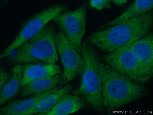 TWIST2 Antibody in Immunocytochemistry (ICC/IF)