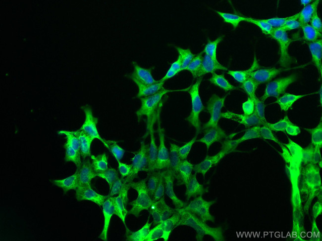 PHD2/EGLN1 Antibody in Immunocytochemistry (ICC/IF)