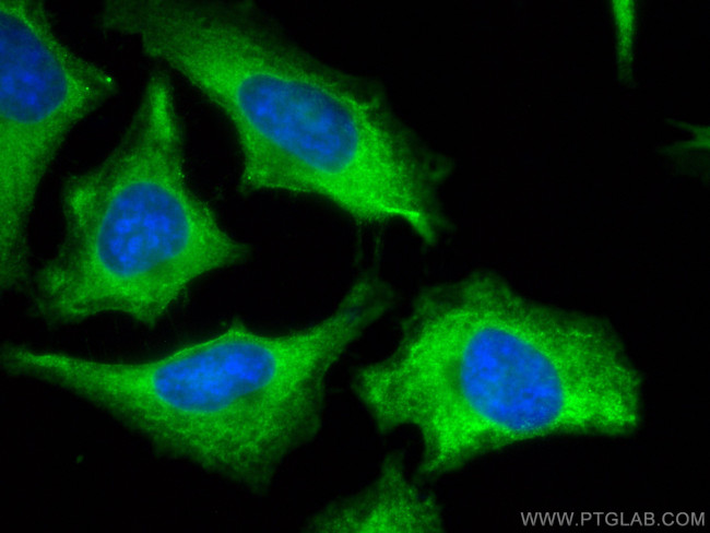 FASN Antibody in Immunocytochemistry (ICC/IF)