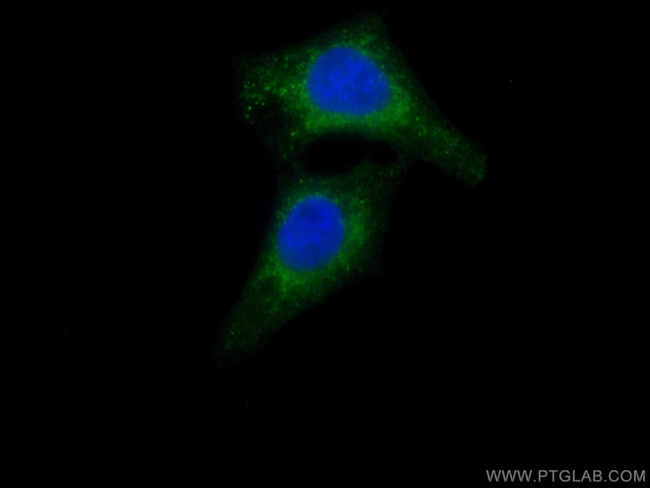 AKR7A2 Antibody in Immunocytochemistry (ICC/IF)