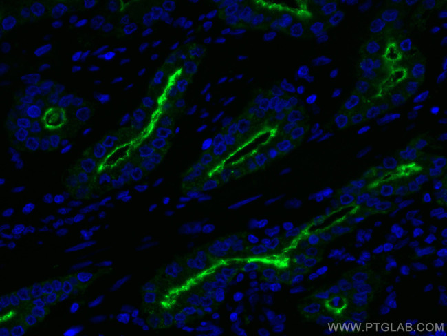 PSMA/GCPII Antibody in Immunohistochemistry (Paraffin) (IHC (P))