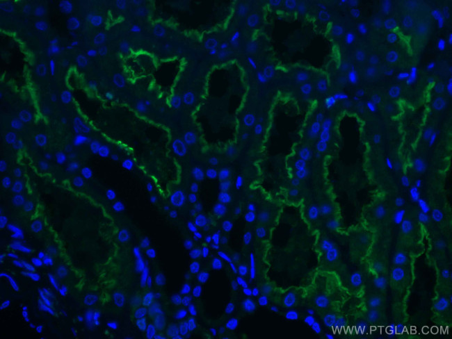 ACE2 Antibody in Immunohistochemistry (Paraffin) (IHC (P))