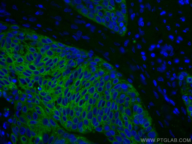 Cytokeratin 5 Antibody in Immunohistochemistry (Paraffin) (IHC (P))