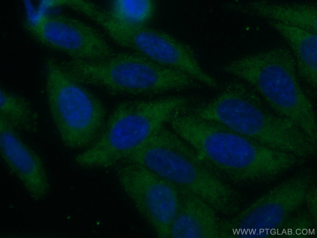 Catalase Antibody in Immunocytochemistry (ICC/IF)