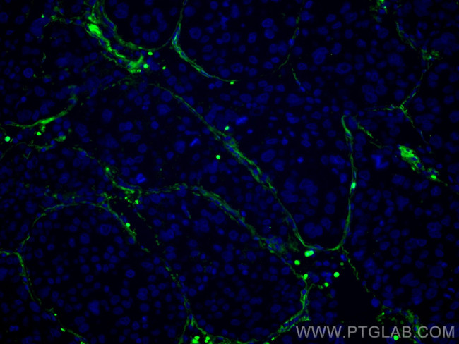 Collagen Type VI Antibody in Immunohistochemistry (Paraffin) (IHC (P))