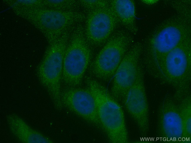 APOE Antibody in Immunocytochemistry (ICC/IF)
