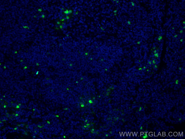 S100A8 Antibody in Immunohistochemistry (Paraffin) (IHC (P))