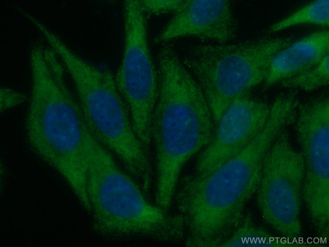 SREBF1 Antibody in Immunocytochemistry (ICC/IF)