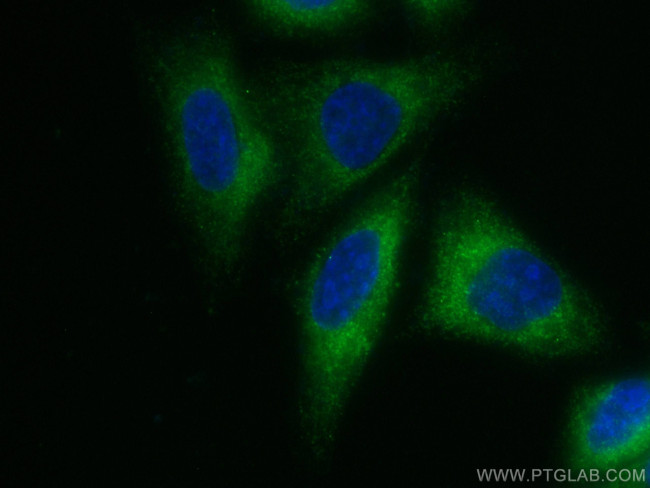 INF2 Antibody in Immunocytochemistry (ICC/IF)