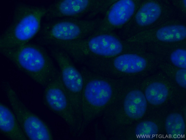 DDX21 Antibody in Immunocytochemistry (ICC/IF)
