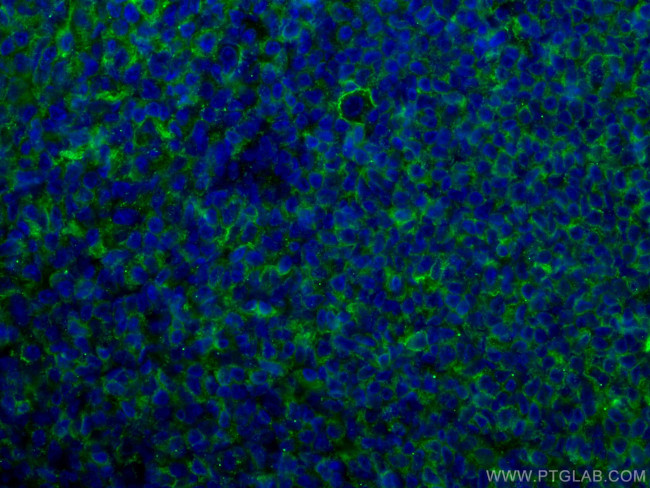 CD40 Antibody in Immunohistochemistry (Paraffin) (IHC (P))
