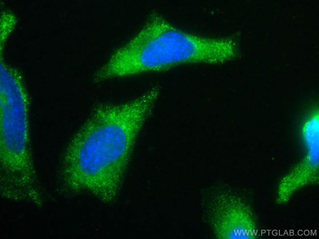hIST1 Antibody in Immunocytochemistry (ICC/IF)