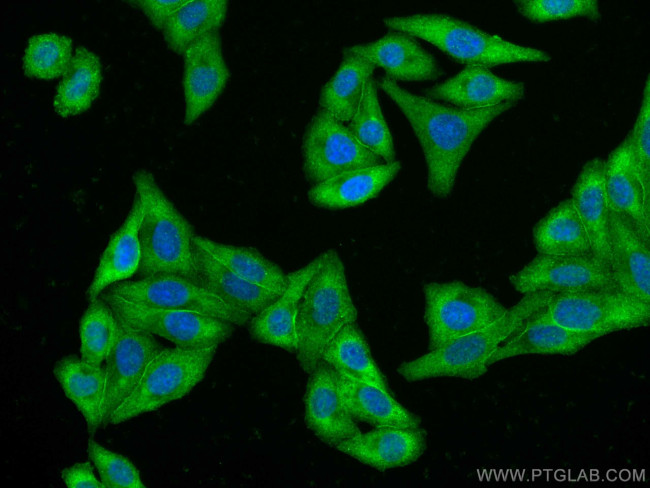 C1QA Antibody in Immunocytochemistry (ICC/IF)