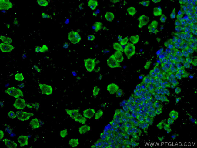 APBB1 Antibody in Immunohistochemistry (Paraffin) (IHC (P))