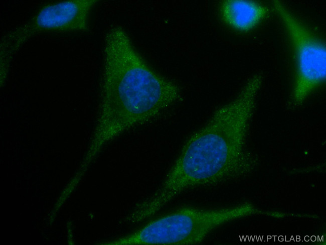 PICK1 Antibody in Immunocytochemistry (ICC/IF)