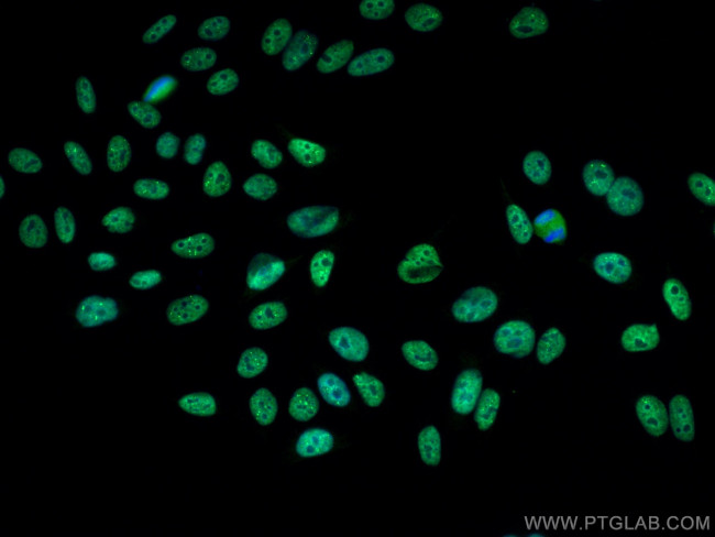 HOXA7 Antibody in Immunocytochemistry (ICC/IF)