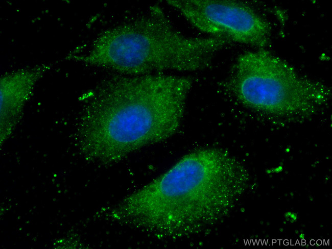 RAB3D Antibody in Immunocytochemistry (ICC/IF)
