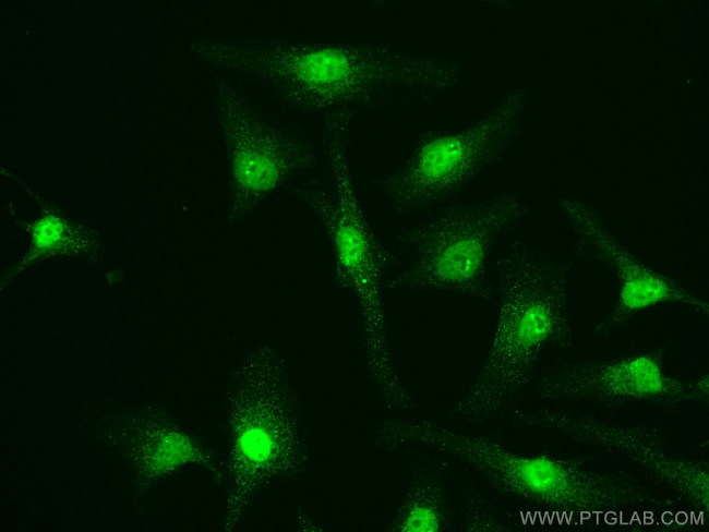 PI3 Kinase p110 Beta Antibody in Immunocytochemistry (ICC/IF)
