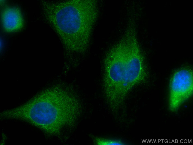 URG4 Antibody in Immunocytochemistry (ICC/IF)