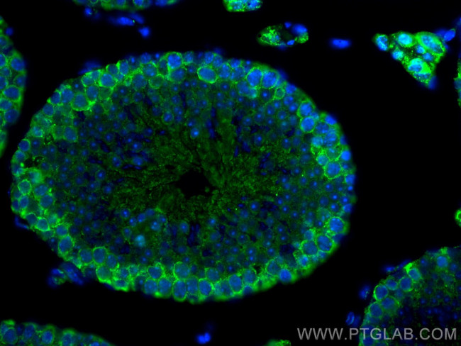 DDX4, VASA Antibody in Immunohistochemistry (Paraffin) (IHC (P))