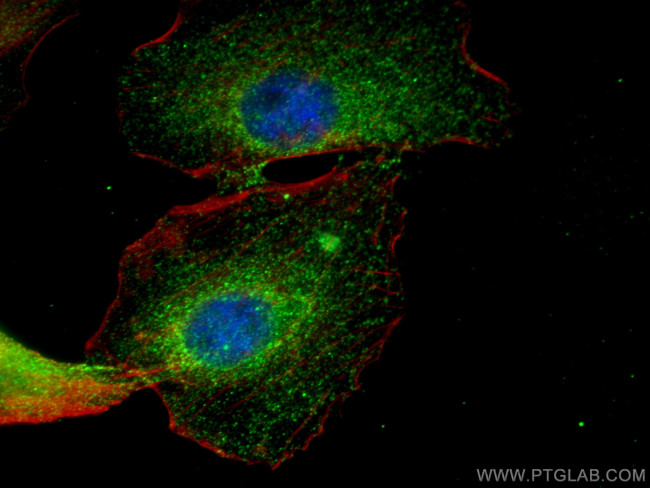 HIP1 Antibody in Immunocytochemistry (ICC/IF)